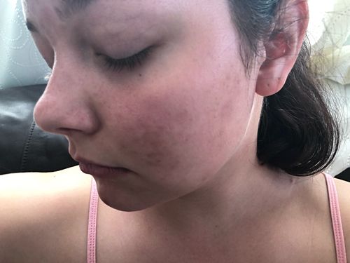Customer Review Photo