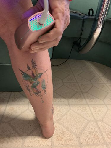 Customer Review Photo