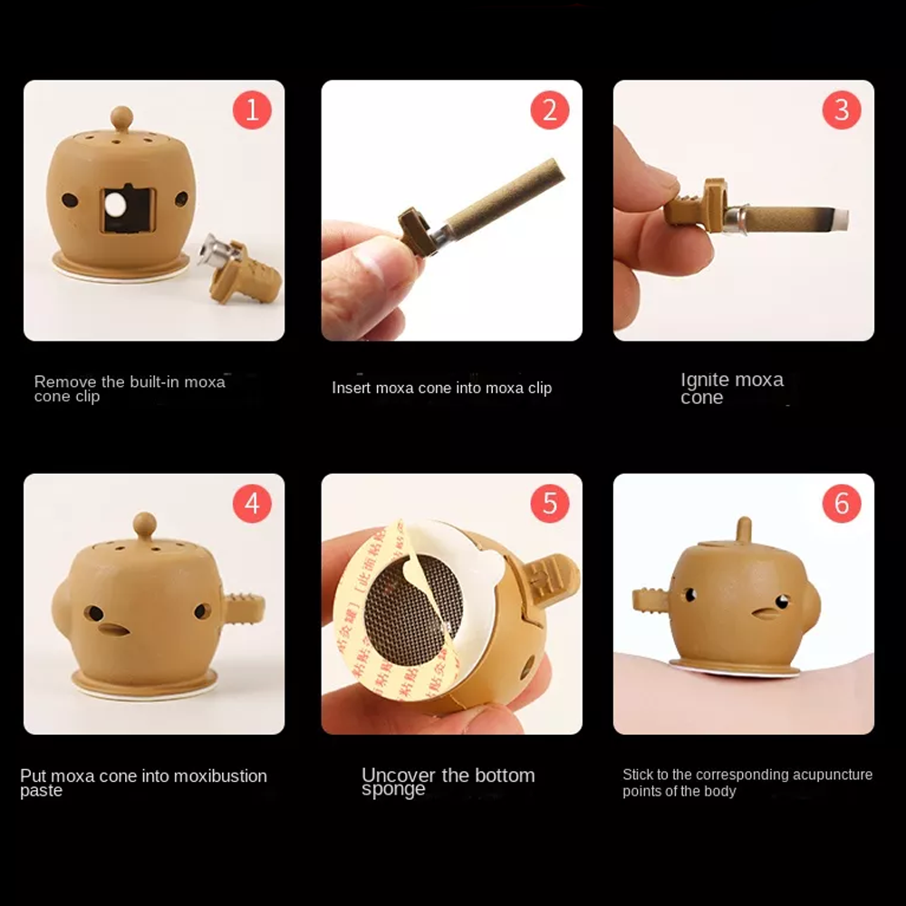 Moxa Cupping Acupuncture Detox Therapy Set Inspire Uplift