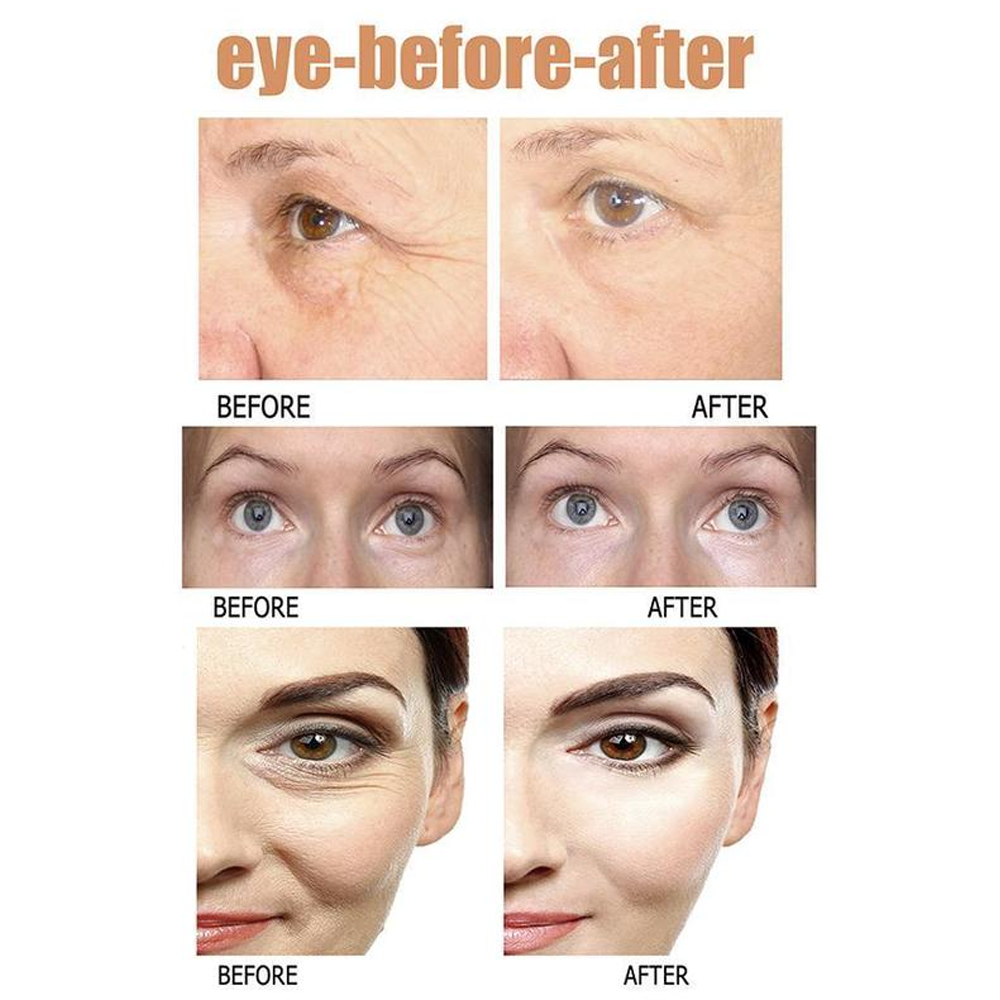 eyeboostserum5.png