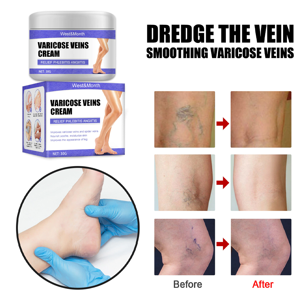 veincarefadingcream4.png
