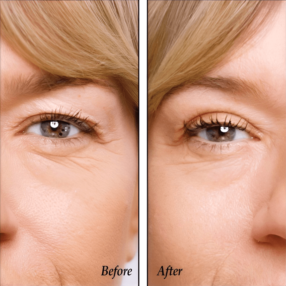 eyelidlifterstape5 (1).png