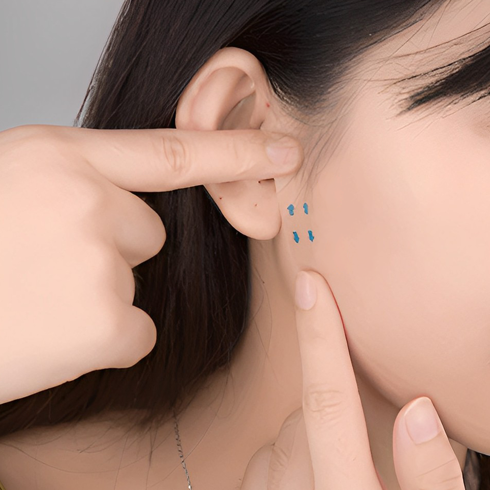 Skin Lifting Tape For Prominent Jawline Inspire Uplift