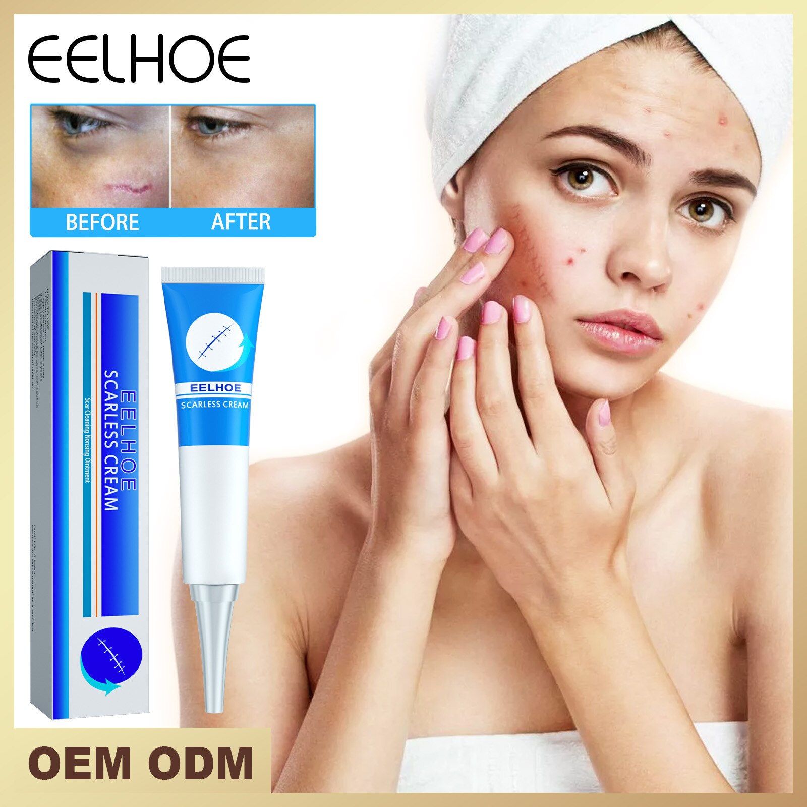 Scar Removal Cream Repairing Pregnancy Surgery Scars Fading Inspire