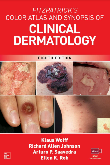 Fitzpatrick's Color Atlas And SYNOPSIS OF Clinical Dermatolo | Inspire ...