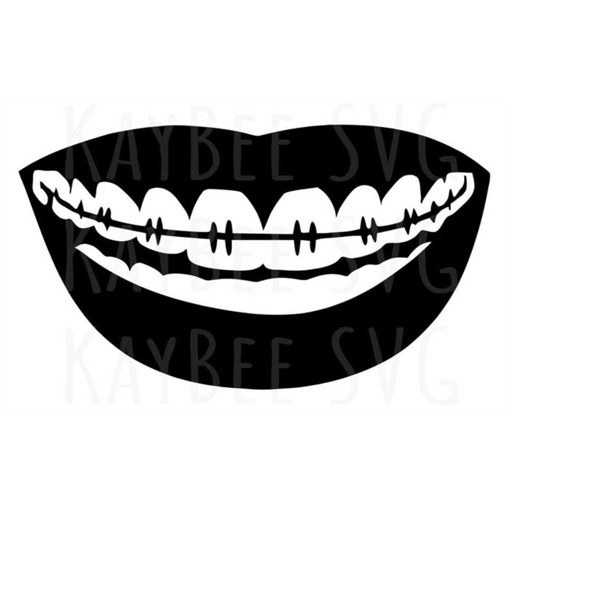 Orthodontic Braces SVG PNG JPG Clipart Digital Cut File Down - Inspire
