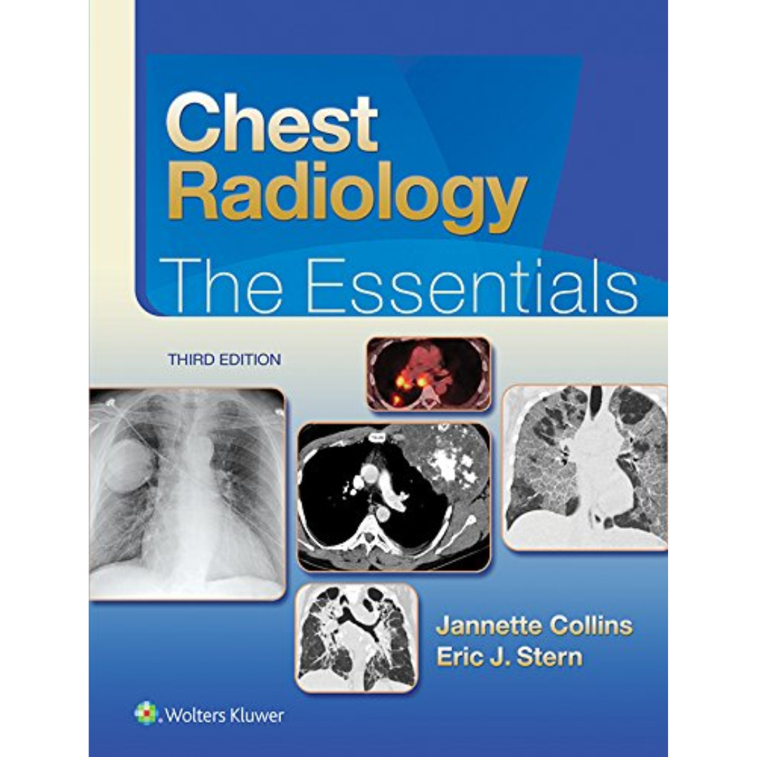 Chest Radiology: The Essentials Essentials Series 3rd Editio | Inspire ...
