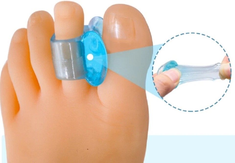 Silicone Gel Bunion Corrector and Toe Separator Orthotic Pain Relief Spacer for Foot Alignment
