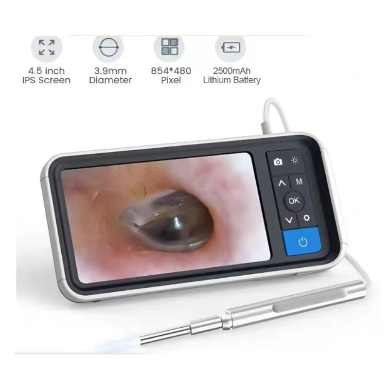 Digital Otoscope with 4.5 Inches Screen 3.9mm Ear Camera | Inspire Uplift