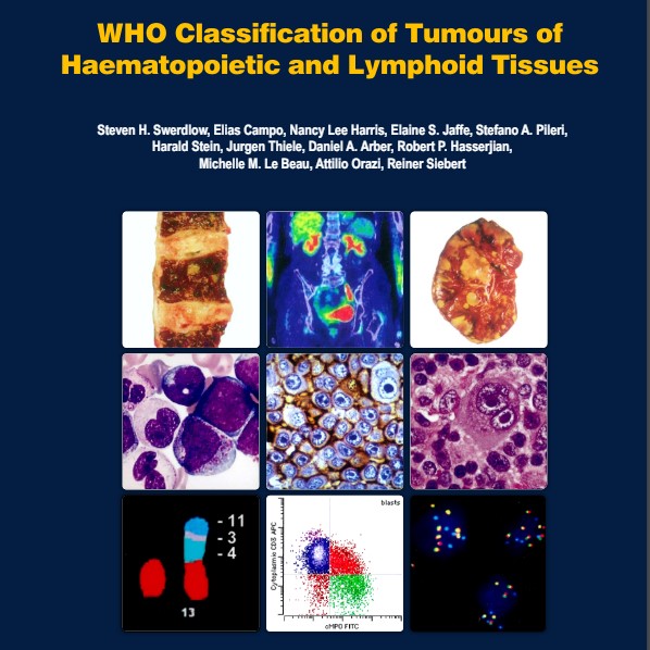 WHO Classification of Tumours of Haematopoietic and Lymphoid - Inspire ...