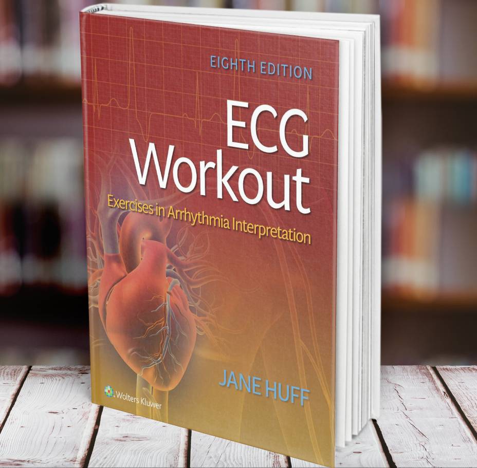 ECG Workout Exercises in Arrhythmia Interpretation, Jane Huf | Inspire ...