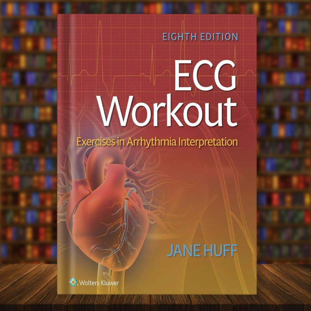 ECG Workout Exercises in Arrhythmia Interpretation, Jane Huf | Inspire ...