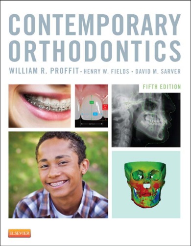 Contemporary orthodontics 5th ed. PDF Instant Download | Inspire Uplift
