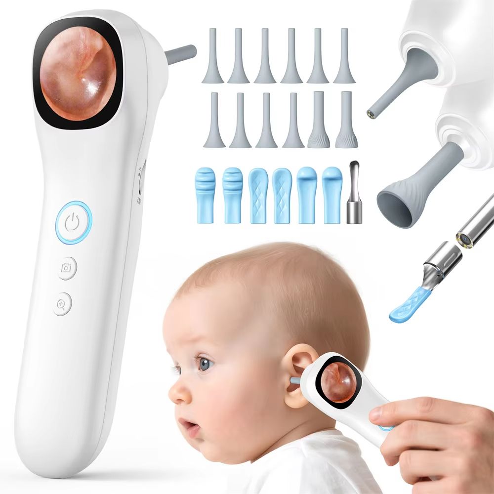 Ear Camera Red HD Visual Ear Camera Monitor – 1.21inch IPS Screen Smart Oto | Inspire ...
