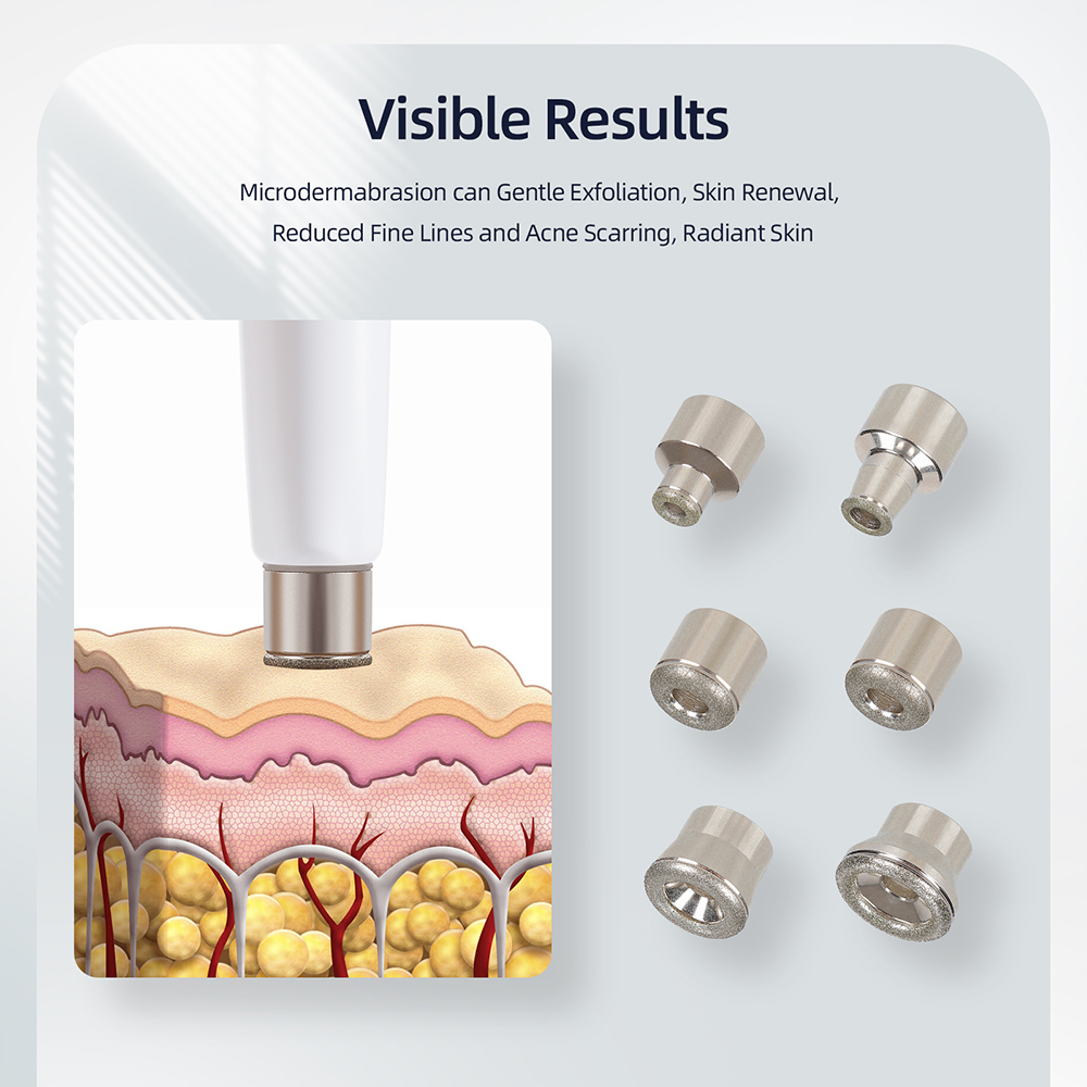 Diamond Facial Peeling Machine for Home Pro Use | Inspire Uplift