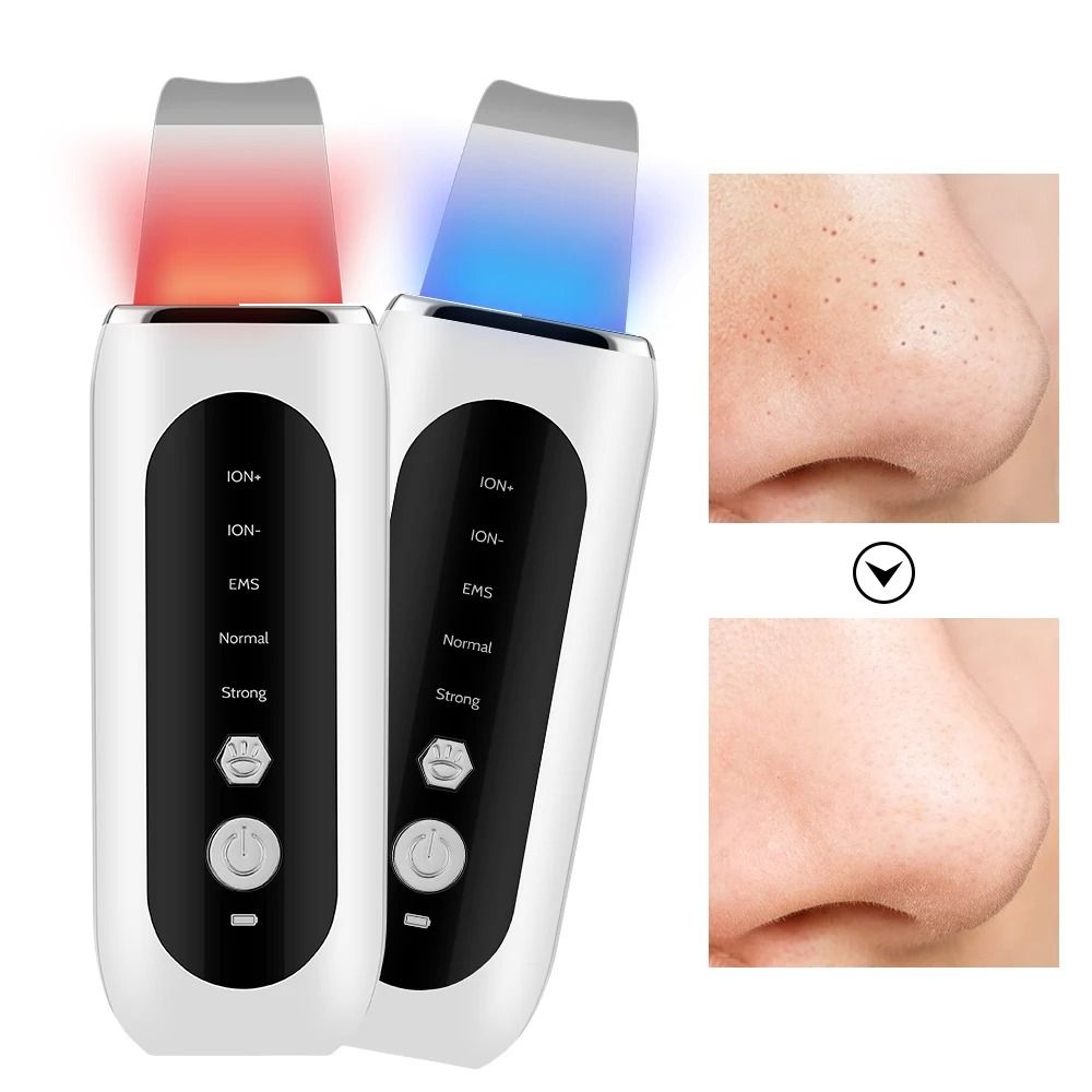 Ultrasonic Skin Scrubber Blackhead Remover Face Spatula